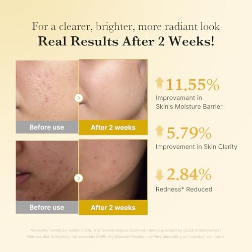 Kojic acid tumeric niaciamide serum