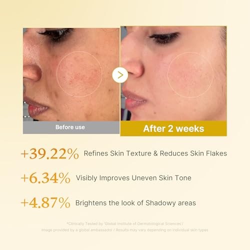 Kojic acid tumeric resurfacing toner+