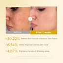 Kojic acid tumeric resurfacing toner+